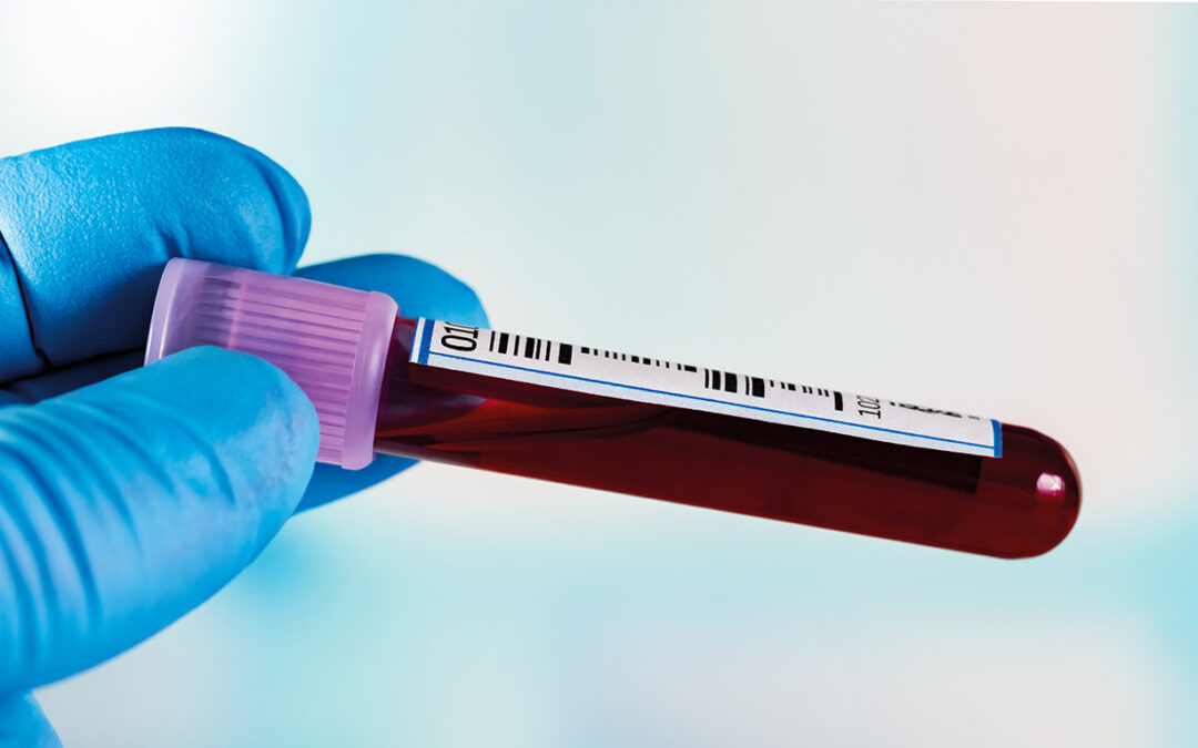 Factores de crecimiento, ¿qué son?