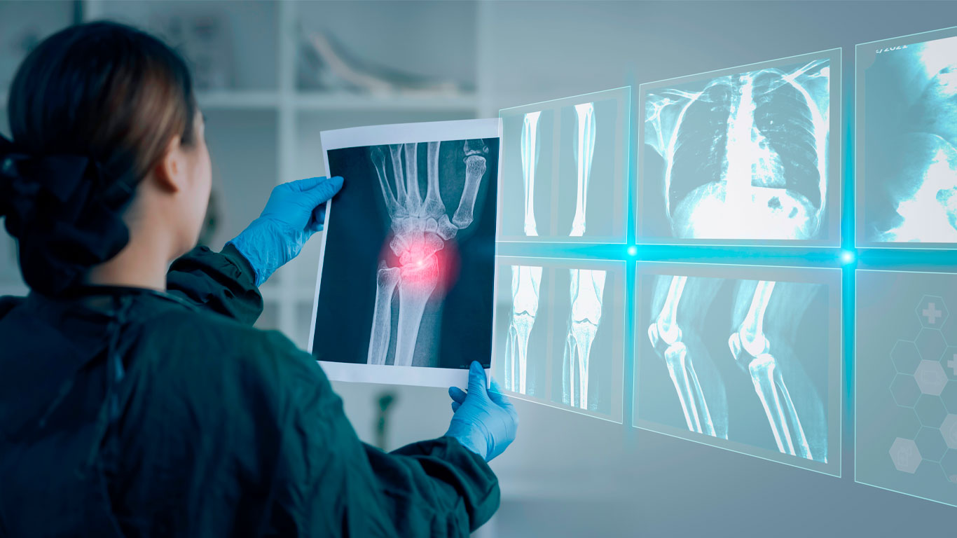 Radiología Diagnóstico Precoz